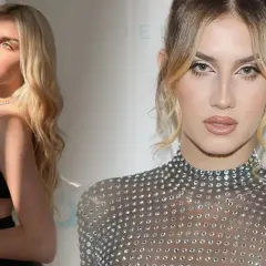 Modelka z bliznami? Tak, to możliwe! Autentyczność to nowy atut w modzie.