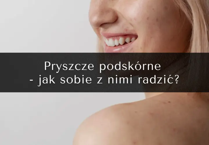 Jak przyspieszyć dojrzewanie pryszcza podskórnego? Skuteczne metody