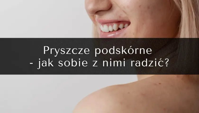 Jak przyspieszyć dojrzewanie pryszcza podskórnego? Skuteczne metody