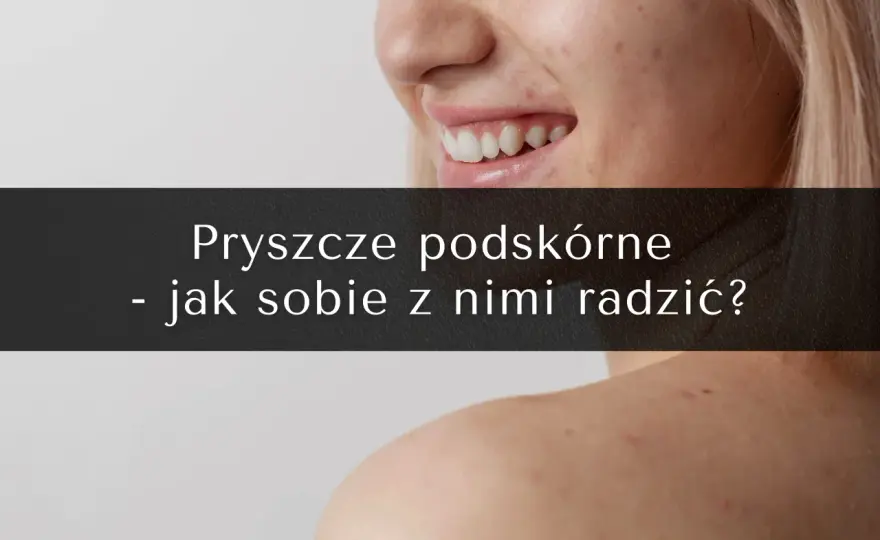 Jak przyspieszyć dojrzewanie pryszcza podskórnego? Skuteczne metody