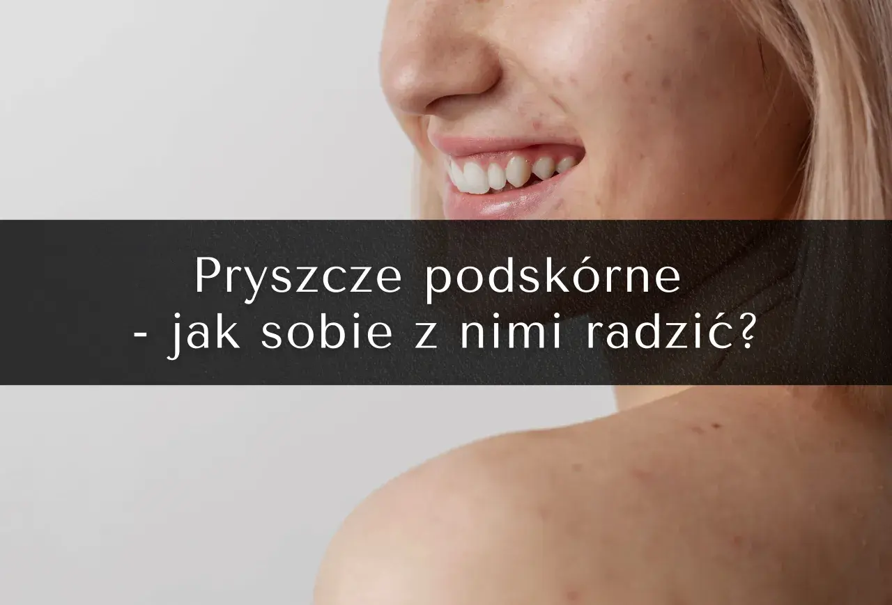 Jak przyspieszyć dojrzewanie pryszcza podskórnego? Skuteczne metody