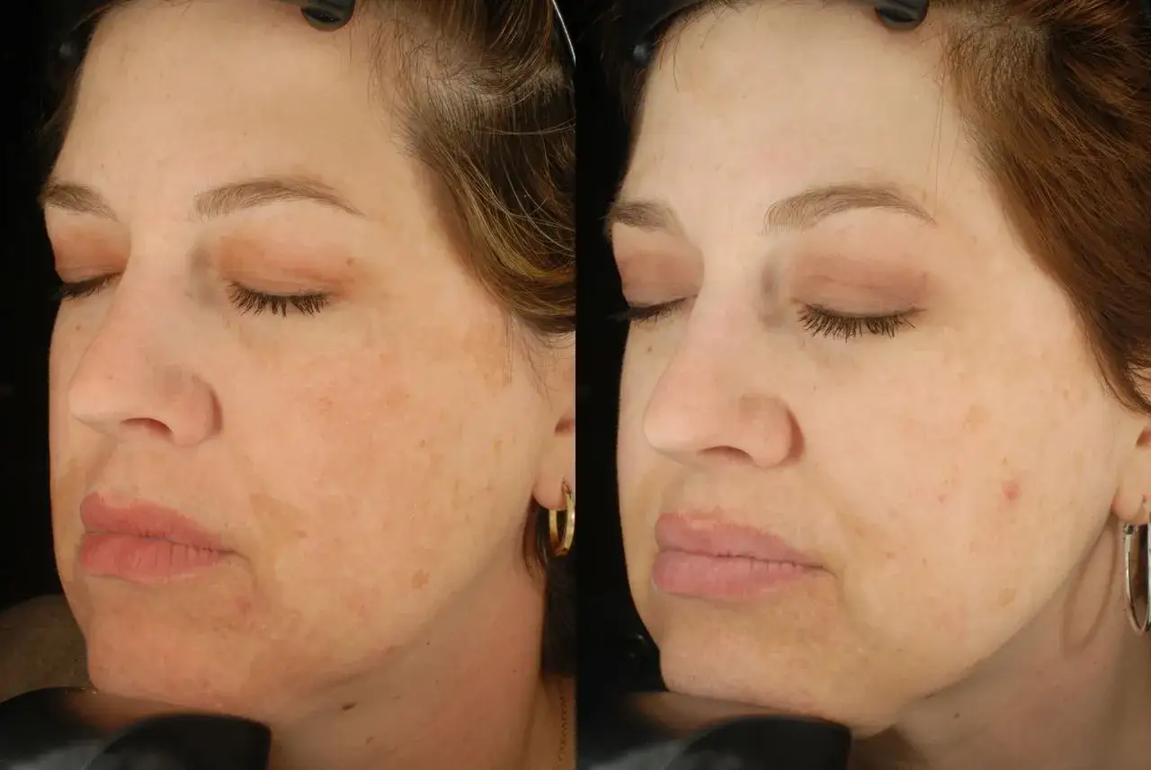 Epionce Renewal Facial Cream Lotion Intensive porównanie